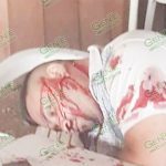 Ataque a marisquería, deja un muerto y un herido