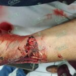 ¡Alertan en El Habillal sobre ataque de cocodrilos!