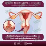 Realiza tu prueba gratuita de Papanicolaou en unidades médicas de la SSM