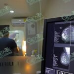 Durante mayo SSM realizará mastografías gratuitas sin agendar cita