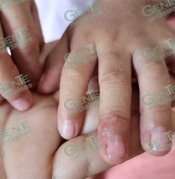 HAY VIRUS COXSACKI, SE PRESENTA EN LC LEJOS DE UNA PANDEMIA: KCT